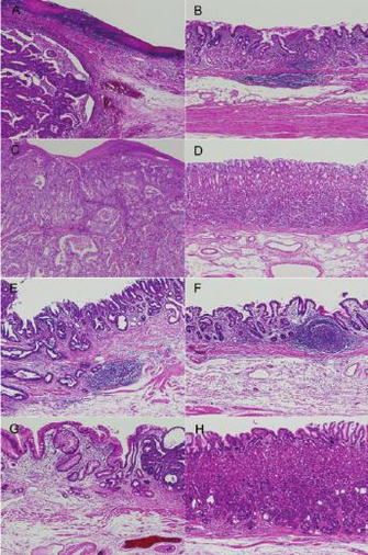 Representative Histology Of Background Fundic Gland Mucosa And