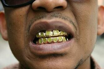 Man Saved By Bulletproof Teeth We Interrupt