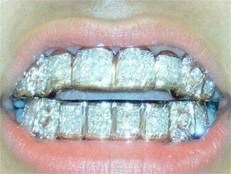 Image About Top And Bottom Grillz