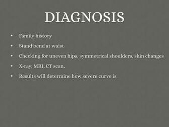 Scoliosis By Johanna Geary