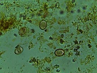 What Is This Protozoa Parasite Can Someone Help In The