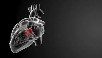 Coronary Issues Bridges United Medical Group