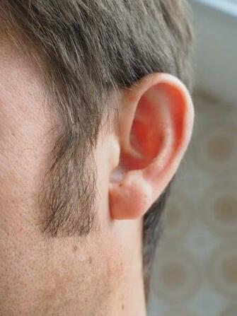 Man S Left Ear Image