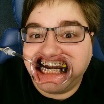 Funny Man Selfie At Dentist Pics People Crazy Selfies Dental Comment