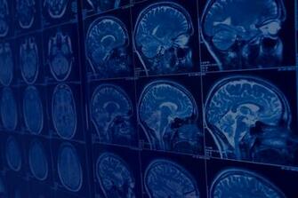 Radiology Associates Of N Ky Diagnostic And Interventional