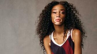 Winnie Harlow It S Beautiful That The Age Of Cookie Cutter