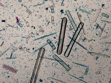 Mod1 Labslides Diatom Microscopic Image