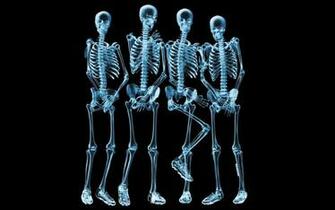 Funny X Ray Pictures Loopele