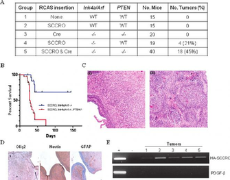 Sccro Overexpression Promotes Glioma Formation In A Facilitated