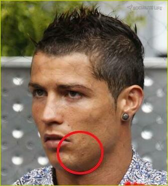 Cristiano Ronaldo Da Sakal Kmamas Uluda S Zl K Galeri