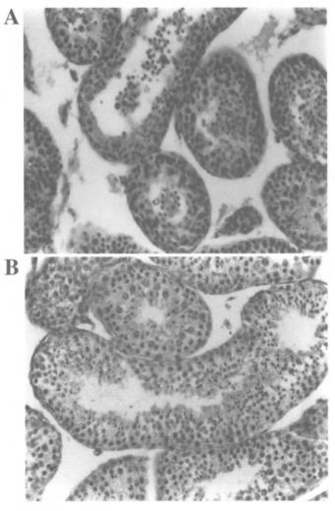 Effects Of Lithium On Viscacha And Rat Sperm Number The