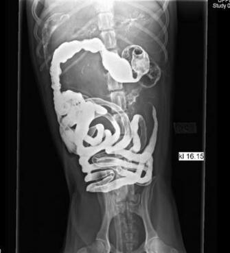 Funny X Ray Image All Wallpaper New