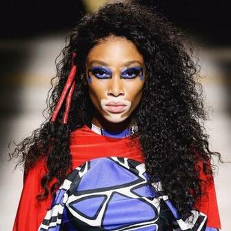 Winnie Harlow Bio Fitness Models Biography