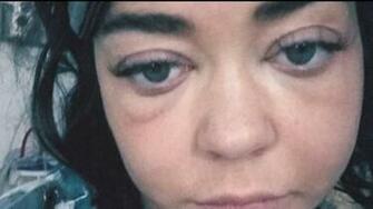 Grieving Sarah Hyland Takes A Break From After Horrible