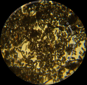Black Mold Pictures Under The Microscopes Awareness