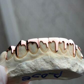 Best Ideas About Gold Teeth Grillz