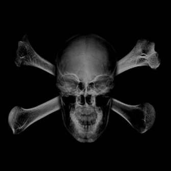 Emo Image Skulls Wallpaper Photos