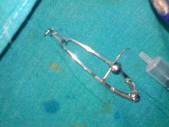 File Medical Instrument Eye Universal Speculum Jpg Wikipedia