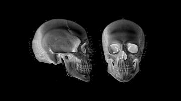 3d Printing And The Murky Ethics Of Replicating Bones