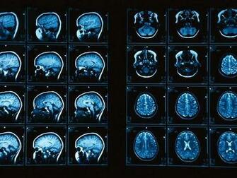 Brain Pictures Photos National Geographic