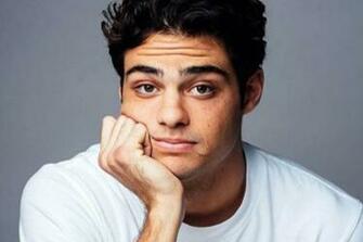 As Es Como Noah Centineo Se Hizo Su Cicatriz De La Cara