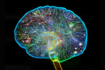 Neurosurgeon By Williamsa4 On Emaze