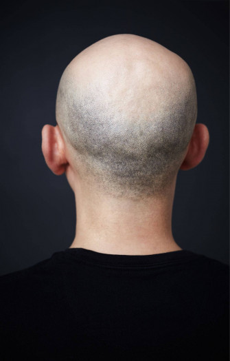 Bald Man Wearing A Black Shirt Wallpaper