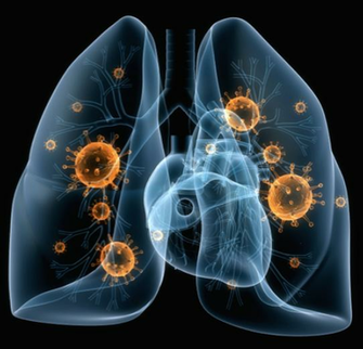 Touro College Of Pharmacy Research On Community Acquired Pneumonia