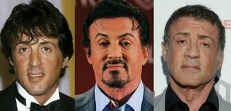 Sylvester Stallone Plastic Surgery Before And After