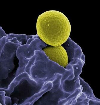 Immunology Wikipedia