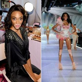 Winnie Harlow Discusses Diversity At The Victoria S Secret Fashion
