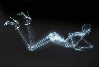 Xray Wallpaper