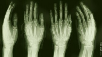 Shaun S Injury Computer Wallpaper Desktop Background