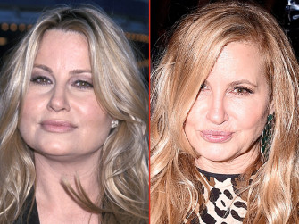 Jennifer Coolidge Good Genes Or Docs