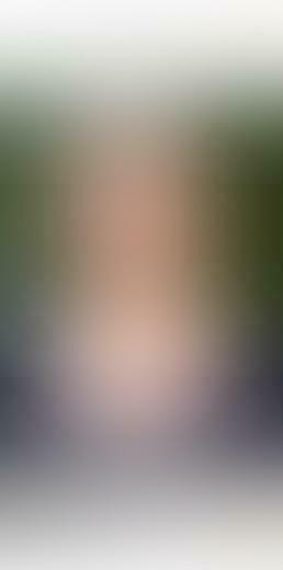 Easy Ways To Blur The Background In Your iPhone Photos