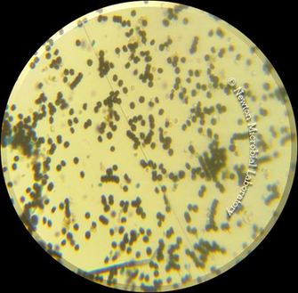Black Mold Pictures Under The Microscopes Awareness