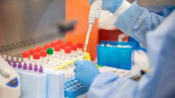 Price Of The Cdc Coronavirus Test Axios