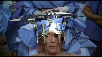 The Beneficial Mischief Of Neurosurgery Psychology Today South