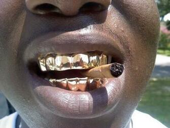 Best Image About Grillz Mouths Follow