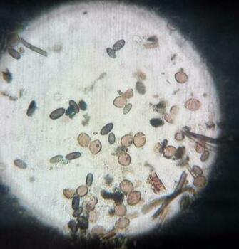 Mold Under Microscope