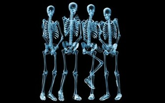 Funny X Ray Pictures Loopele