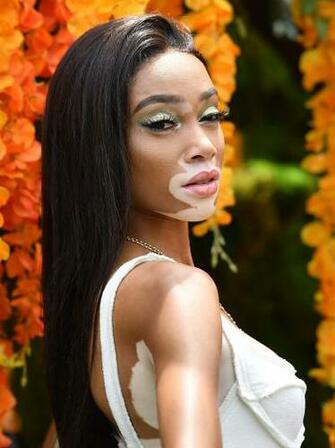 Winnie Harlow Says Hair Makeup Artists Are Still Failing Black