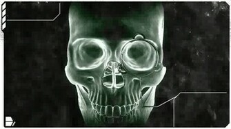 Human Skull X Ray Wallpaper