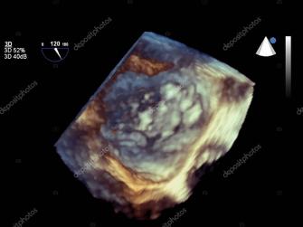 Modern 3d Echocardiography Stock Photo Aff