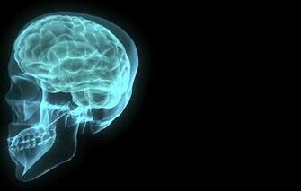 Wallpaper X Ray Skull Human Medical Science Miscellanea