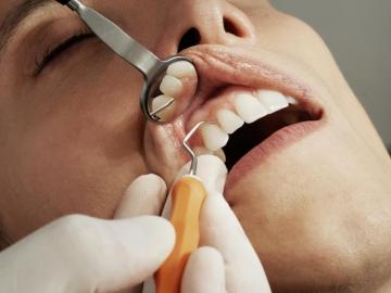Best Dentist Pictures HD Image
