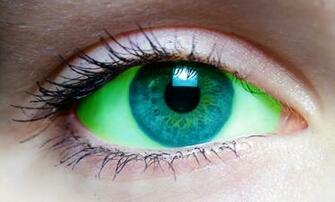 Septic Eye By Theoutlawlion