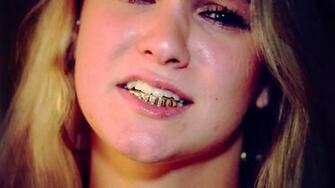 Top Gold Teeth Wallpaper